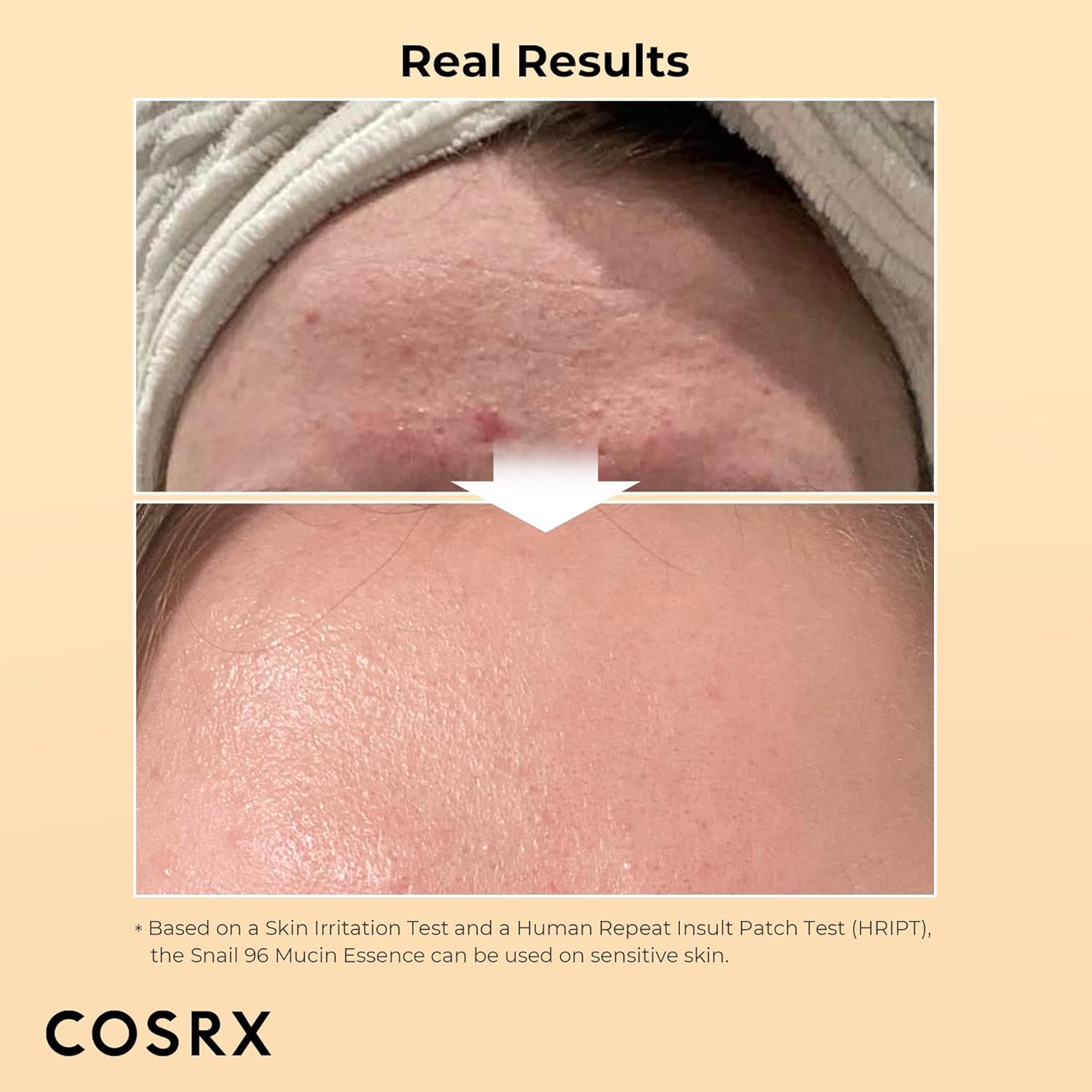 Hydrating Serum -Snail Secretion Filtrate by COSRX